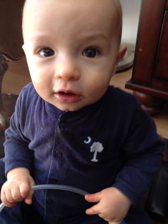 Poor little snot face